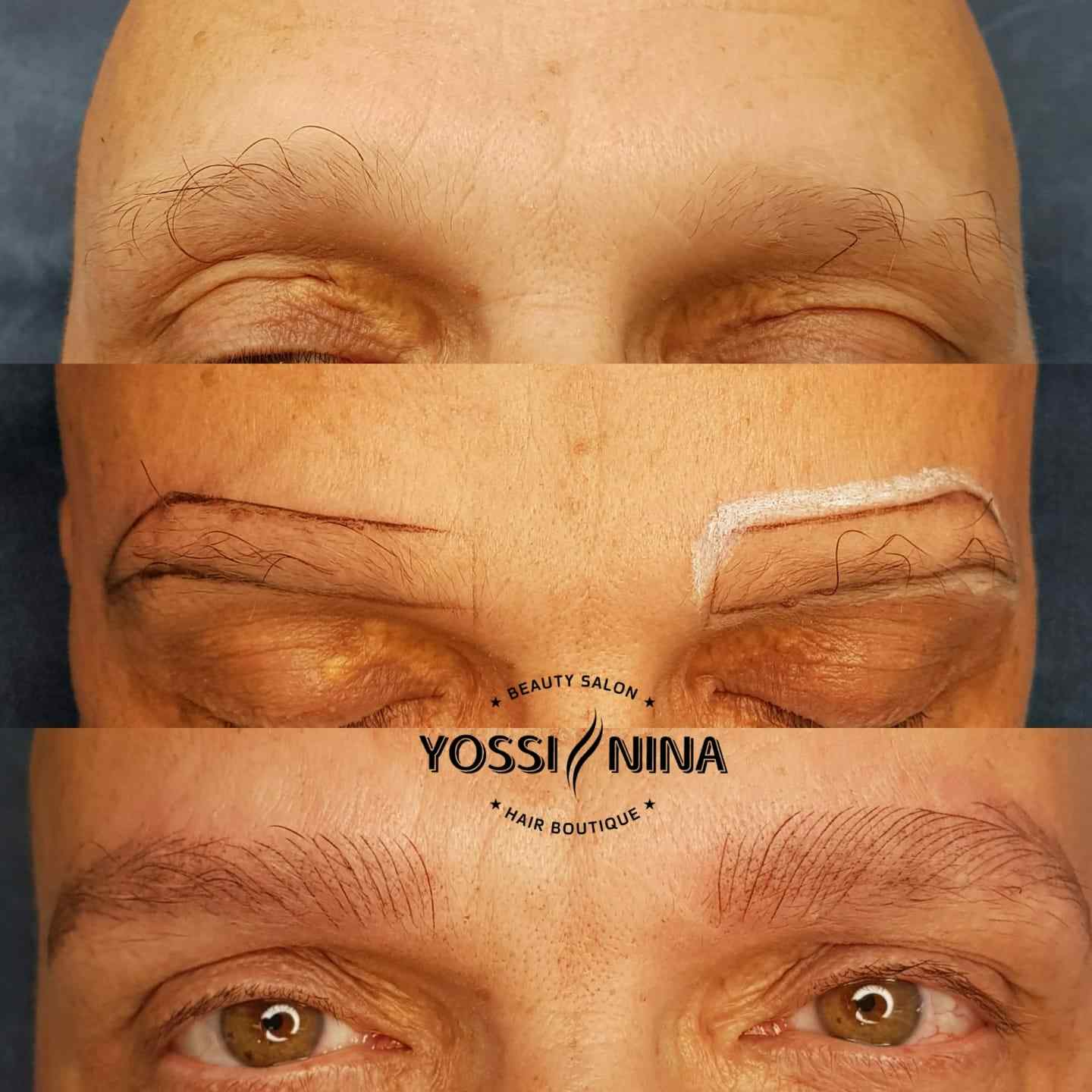 מחלקת מיקרובליידינג (6)