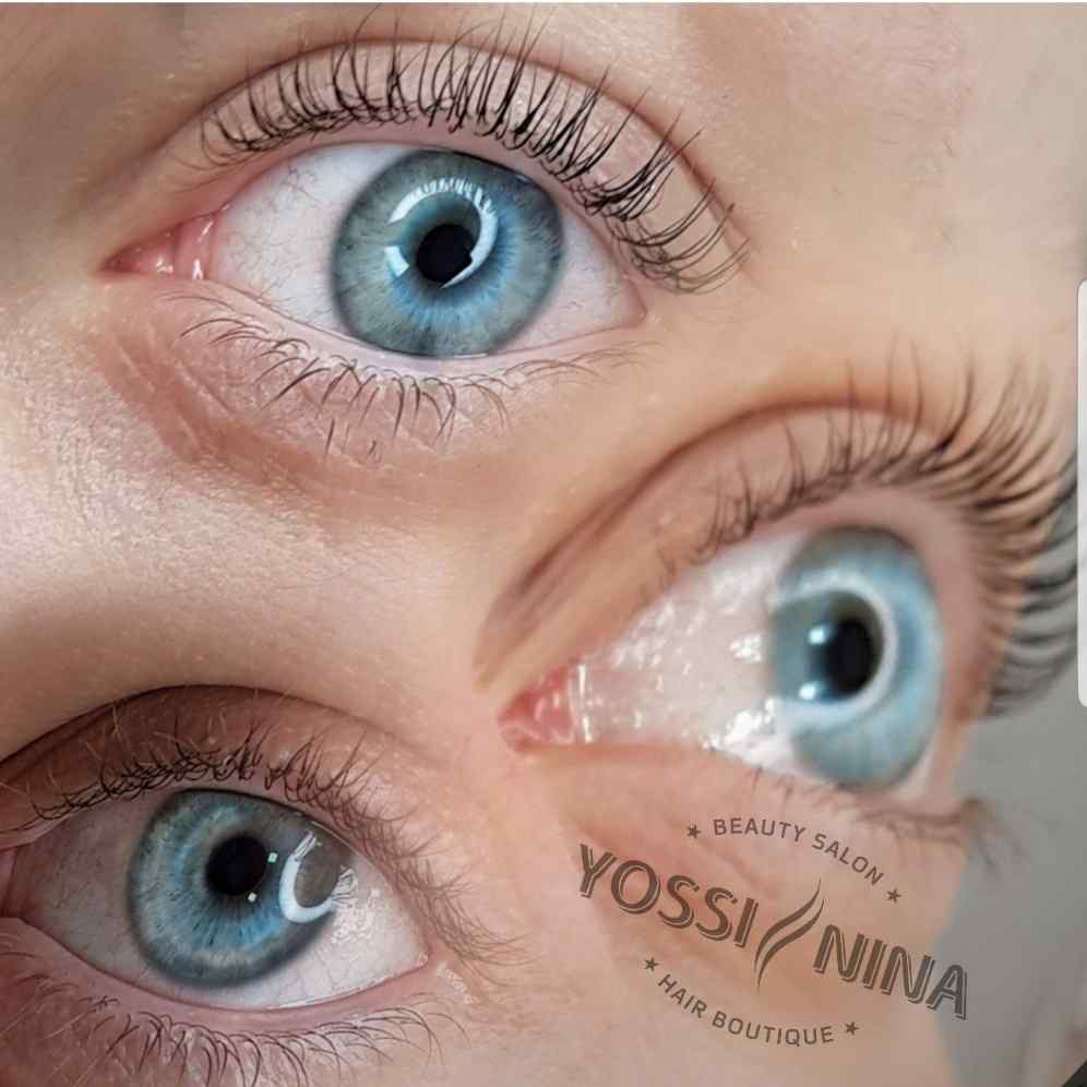 מיקרונידלינג (1)