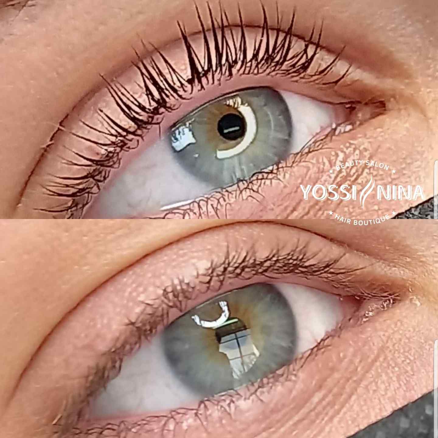 מיקרונידלינג (2)