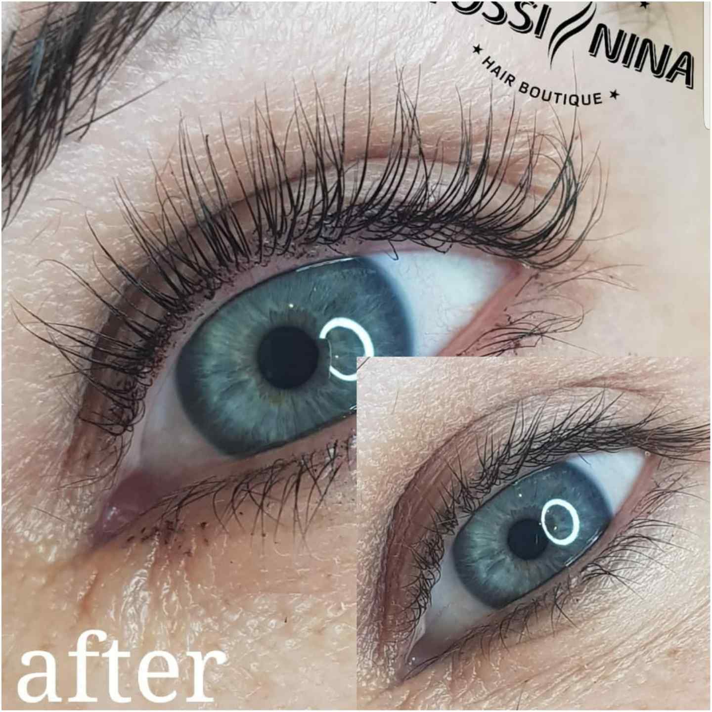 מיקרונידלינג (3)