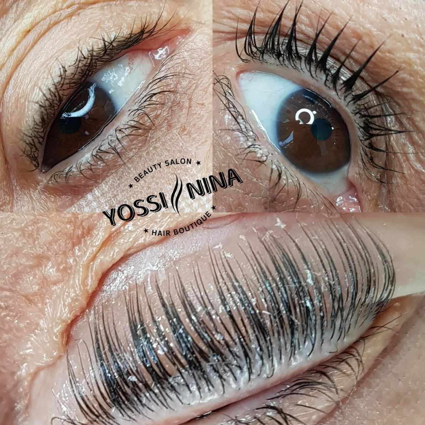 מיקרונידלינג (4)