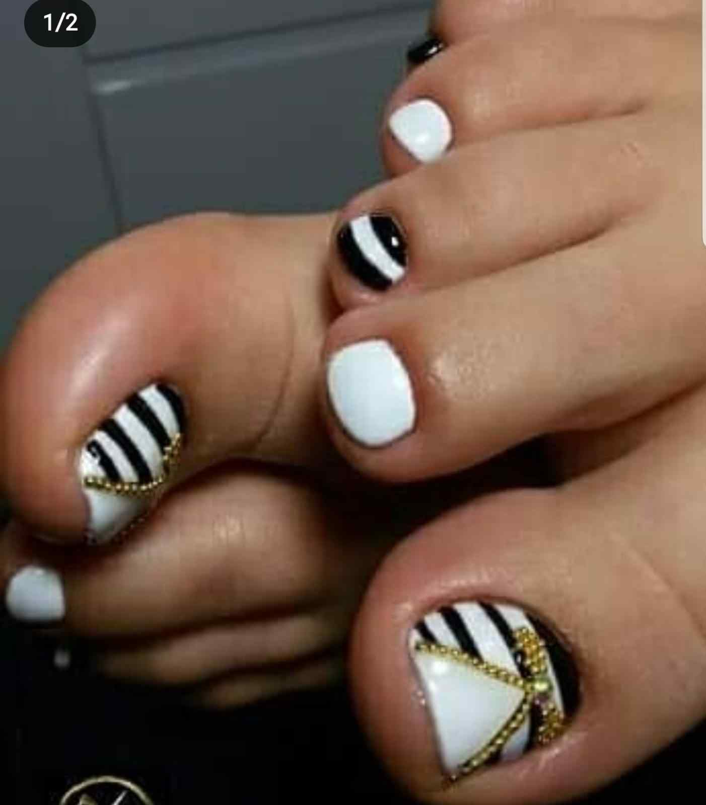 פדיקורפדיקור רפואי (2)